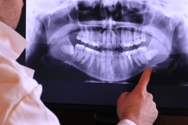 Best Emergency Tooth Extraction in Louisville, GA